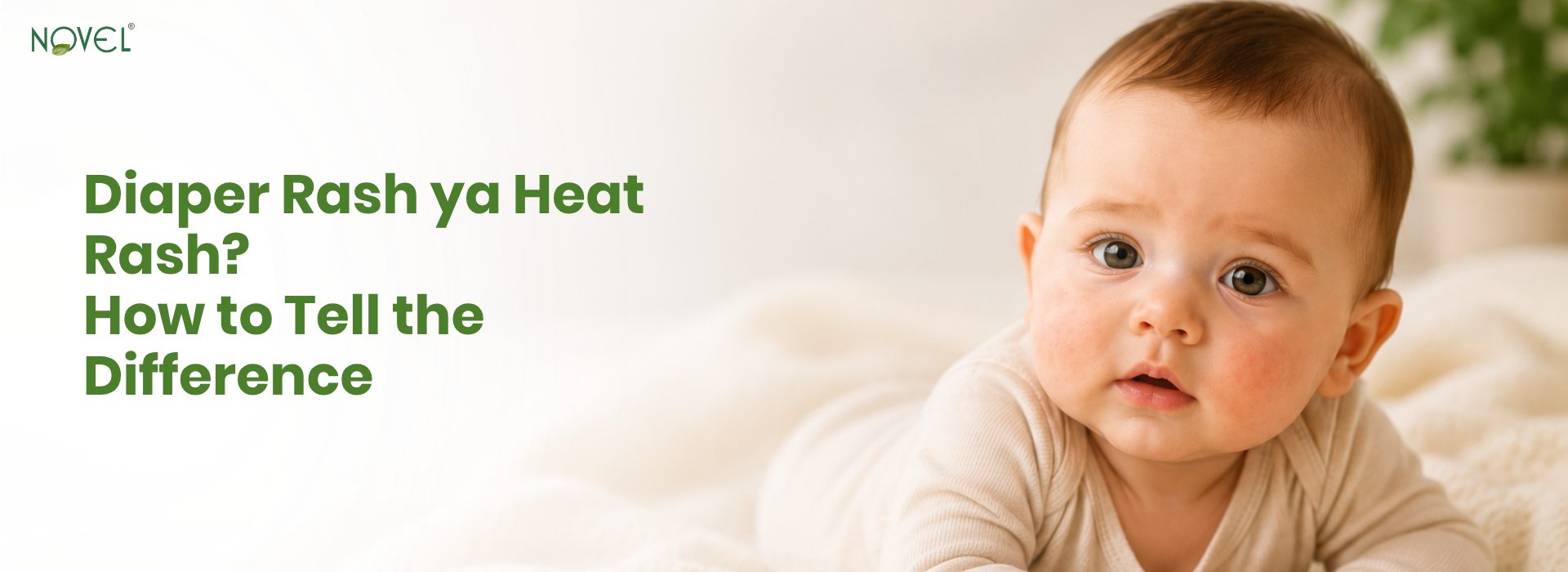 Diaper Rash ya Heat Rash? How to Tell the Difference