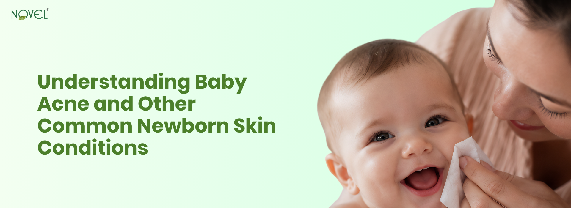 Close-up of a newborn's face with mild baby acne and common skin conditions